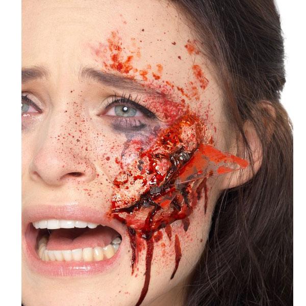 (image for) Broken Glass Wound